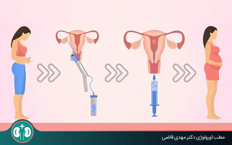 آی یو آی