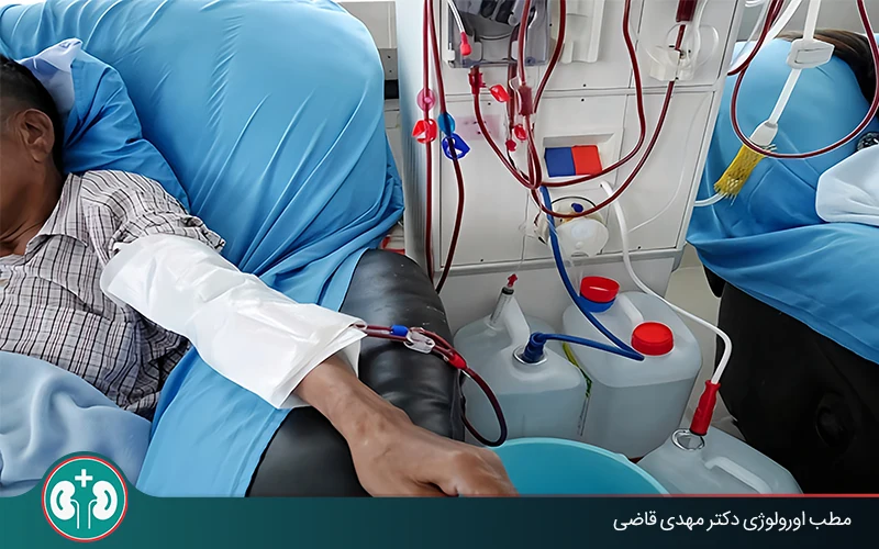 دیالیز چیست و چگونه انجام می‌شود؟