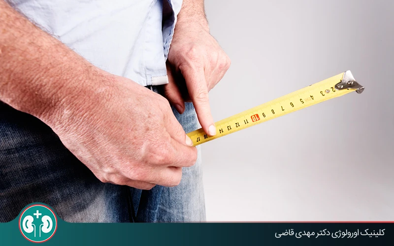 Scientific Review of Jelqing Exercises for Penis Enlargement: Risks and Alternatives