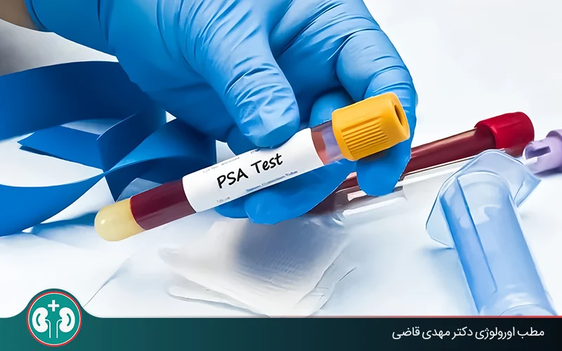 Interpreting PSA After Prostate Surgery: Does a Rising Level Mean Cancer?