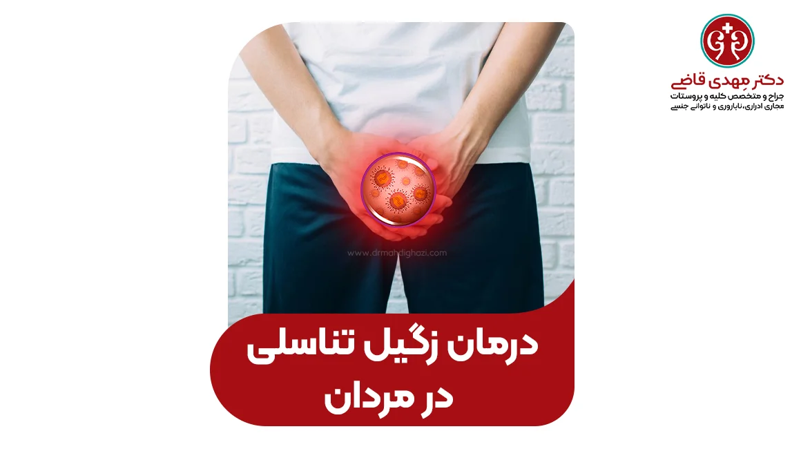 درمان زگیل تناسلی مردان؛ بررسی و مقایسه روشهای مختلف درمان
