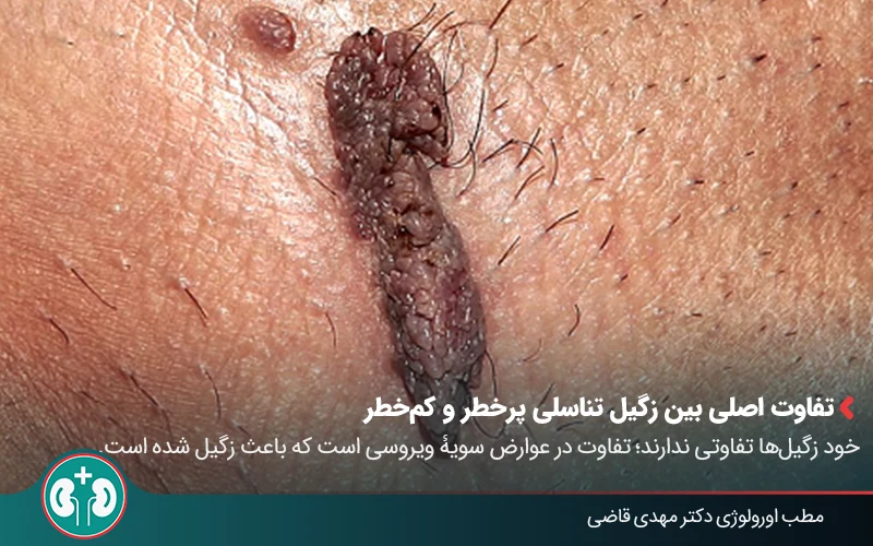 علائم زگیل تناسلی بدخیم + روش‌های تشخیص و درمان