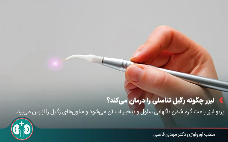 درمان زگیل تناسلی با لیزر | مقایسه با سایر روش‌ها