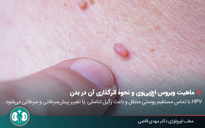 ویروس HPV چیست؟ روش‌های انتقال، پیشگیری و درمان